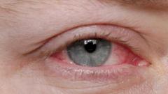 Москвич 25 лет ходил с осколком стекла в веке