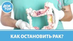 Остановим колоректальный рак! В каких регионах действует программа?