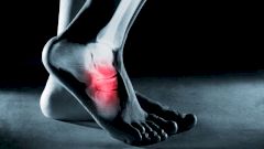 Первая помощь при растяжении связок голеностопного сустава