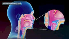 Заболевания лор-органов
