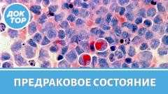 Что такое миелодиспластический синдром