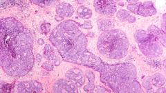 Количество исследований рака отрицательно влияет на борьбу с болезнью