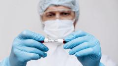 оспа обезьян