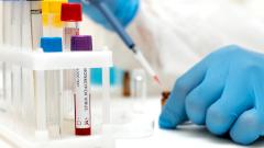 оспа обезьян, россия