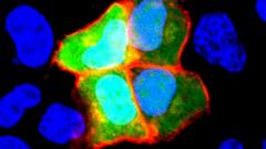 аутоантитела, клетки, шизофрения