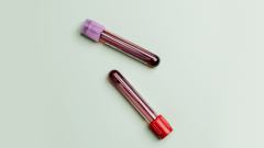 Разработан анализ для выявления риска болезни Паркинсона до первых симптомов