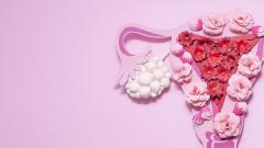 Миома матки: симптомы и лечение