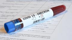 В Роспотребнадзоре назвали срок появления поражения легких при «Омикроне»