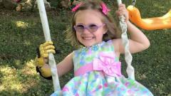 Малышке подобрали протез для замены потерянных пальцев