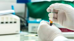 Озвучена новая версия о нулевом пациенте c ВИЧ