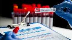 Новосибирские учёные впервые в России получили антитела к коронавирусу