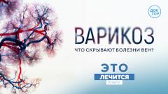 Пиявки не помогут: разоблачение мифов о лечении варикоза в программе «Это лечится» на «Докторе»