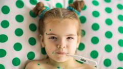 В России выросла заболеваемость корью, ветрянкой, паротитом и коклюшем