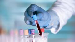 Российские ученые научились предсказывать исход COVID-19 по анализу крови пациента