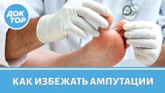 Как не пропустить первые признаки развития диабетической стопы