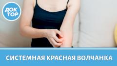 Врач-ревматолог ответил на вопросы о системной красной волчанке