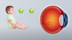 Пресбиопия