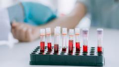 Ученые предложили тест по измерению уровня белка, указывающего на деменцию