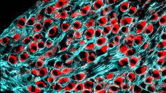 Находки Доктора: нерв, гений и браслет