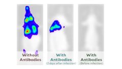 Ученые показали, как коронавирус поражает клетки организма