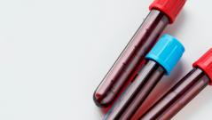 Разработана искусственная кровь, совместимая со всеми группами