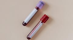 Новый анализ крови выявляет рак за 3 года до постановки диагноза