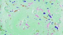 Обнаружены тревожные последствия присутствия микропластика в пище