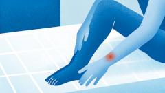 Загрязнение воздуха связали с кожными проблемами