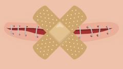 Что делать, если разошелся шов после операции