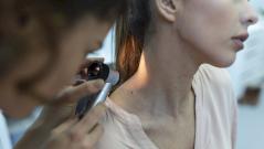 Как определить опасную родинку