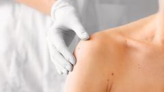 Открыт способ уничтожения «плохих» иммунных клеток, вызывающих болезни кожи