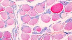 Российские ученые создали основу для иммунотерапии хронических вирусных инфекций