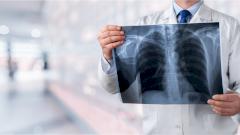 Экспериментальное лечение рака легких показало многообещающие результаты