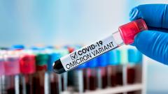 Названы сроки, когда «Омикрон» накроет Россию