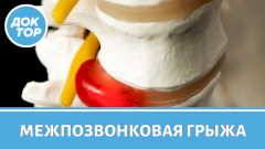 Межпозвонковая грыжа: удалять или нет