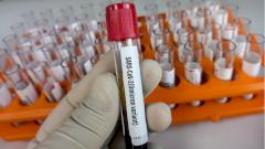 В Роспотребнадзоре назвали долю «стелс-омикрона» среди всех заражений в России