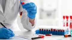 алгоритм, быстро определяющий ковид по маркерам крови