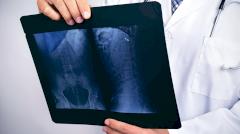 з желудка пациента достали 45-сантиметровую бутылку