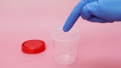 Простой анализ мочи может выявить рак за 10 лет до появления симптомов