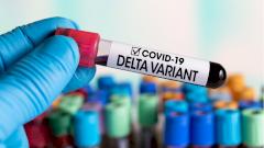 Эксперт РАН оценил возможность самоликвидации штамма «Дельта»