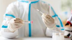 Российский вирусолог предположил, что «Омикрон» вывели искусственным путем