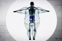 Что такое избыточный вес и ожирение?