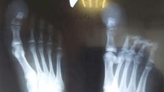 В Подмосковье помогли девочке с гигантским пальцем ноги