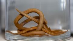 Врачи вытащили живую нематоду из мозга человека