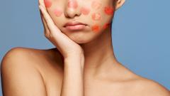 Чем опасна скарлатина XXI века