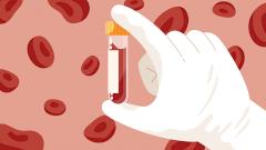 Новый анализ крови приблизил медицину к разгадке тайны рассеянного склероза