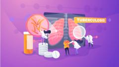 Найден новый способ лечения лекарственно-устойчивого туберкулеза