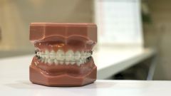 Неочевидная связь: как прикус влияет на осанку?