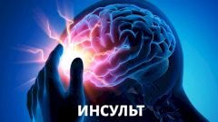 Как распознать инсульт? Методики восстановления после инсульта, которые работают