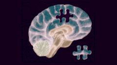 Первое в мире лекарство от болезни Альцгеймера успешно испытано